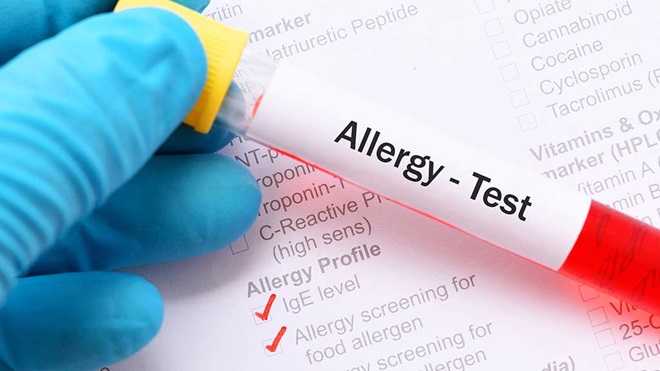 food allergy blood test